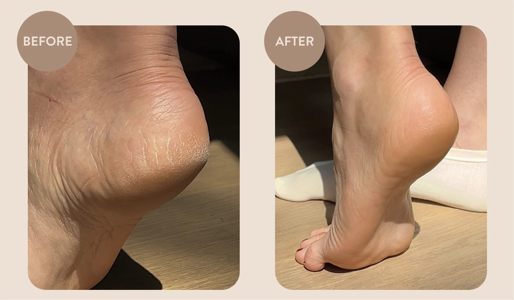 Overnight Foot Rescue Bundle - Image 5